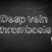Early signs and risk factors of deep vein thrombosis